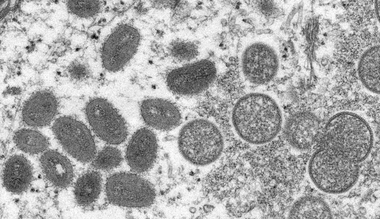 EUA intensifica a vacinação contra a varíola dos macacos