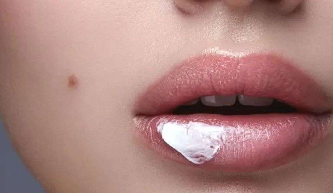 Saiba como tratar e prevenir o ressecamento labial