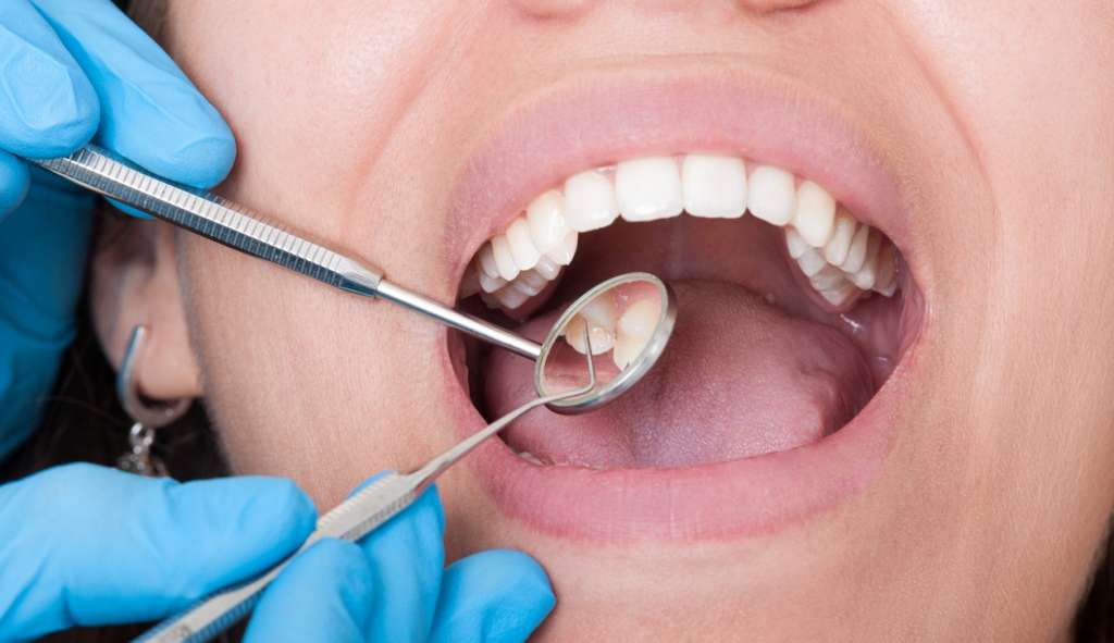 Entenda como o cuidado com saúde bucal pode prevenir doenças