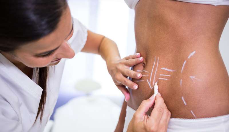Lipo Lad: entenda a diferença em relação à lipoaspiração tradicional