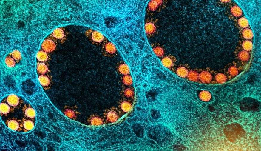 BQ.1: Saiba tudo sobre a nova subvariante da ômicron descoberta no Brasil