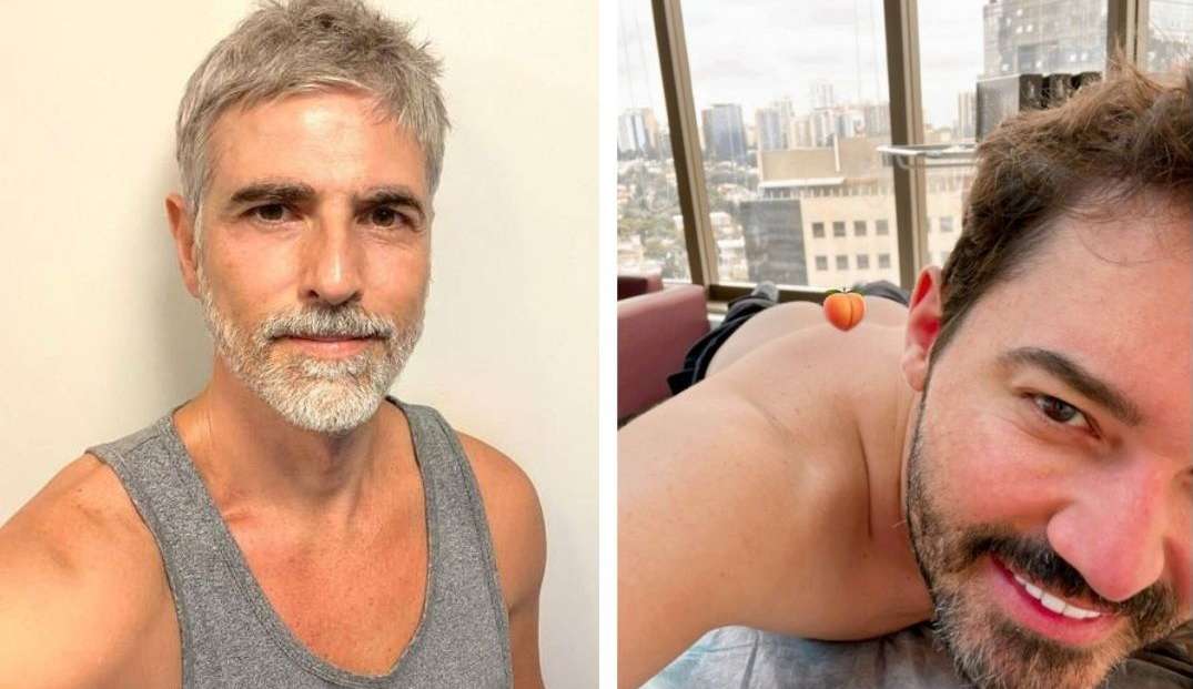 Aumento de procedimentos estéticos entre os homens chama atenção