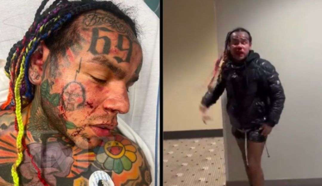 Rapper Tekashi 6ix9ine é espancado em emboscada