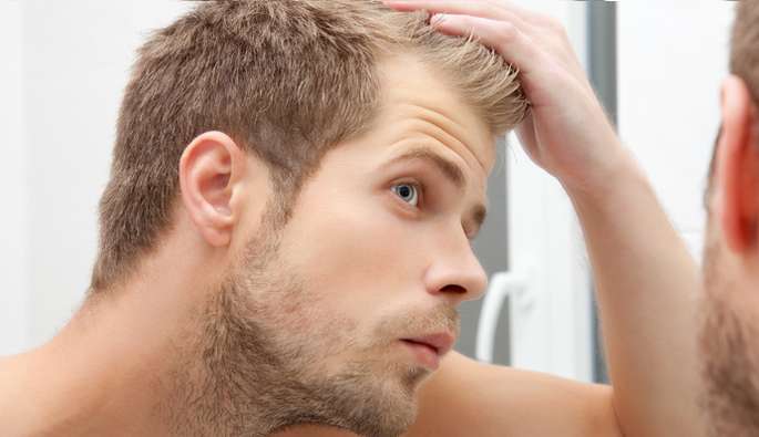 Entenda as doenças de calvície como a Alopecia