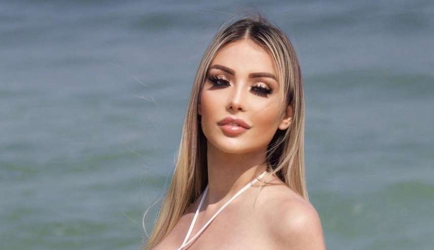Lygia Fazio morre após complicações por uso de silicone industrial e PPMA