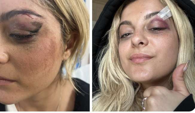Celebridades mostram apoio a Bebe Rexha nas redes sociais após agressão
