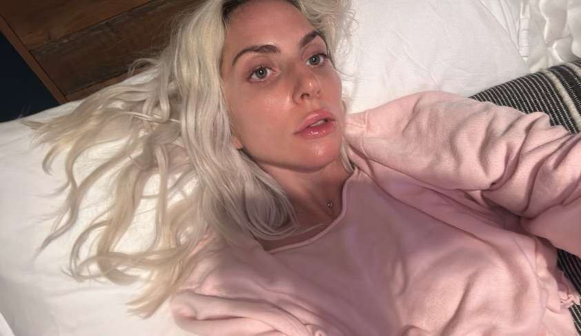 Confira artistas que apostam no visual natural e não tem medo dos comentários