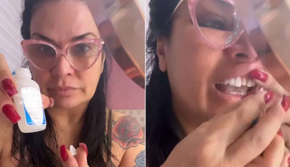 Colar Lente De Contato Dental Com Super Cola? Veja o Que Especialistas Dizem Sobre Isso