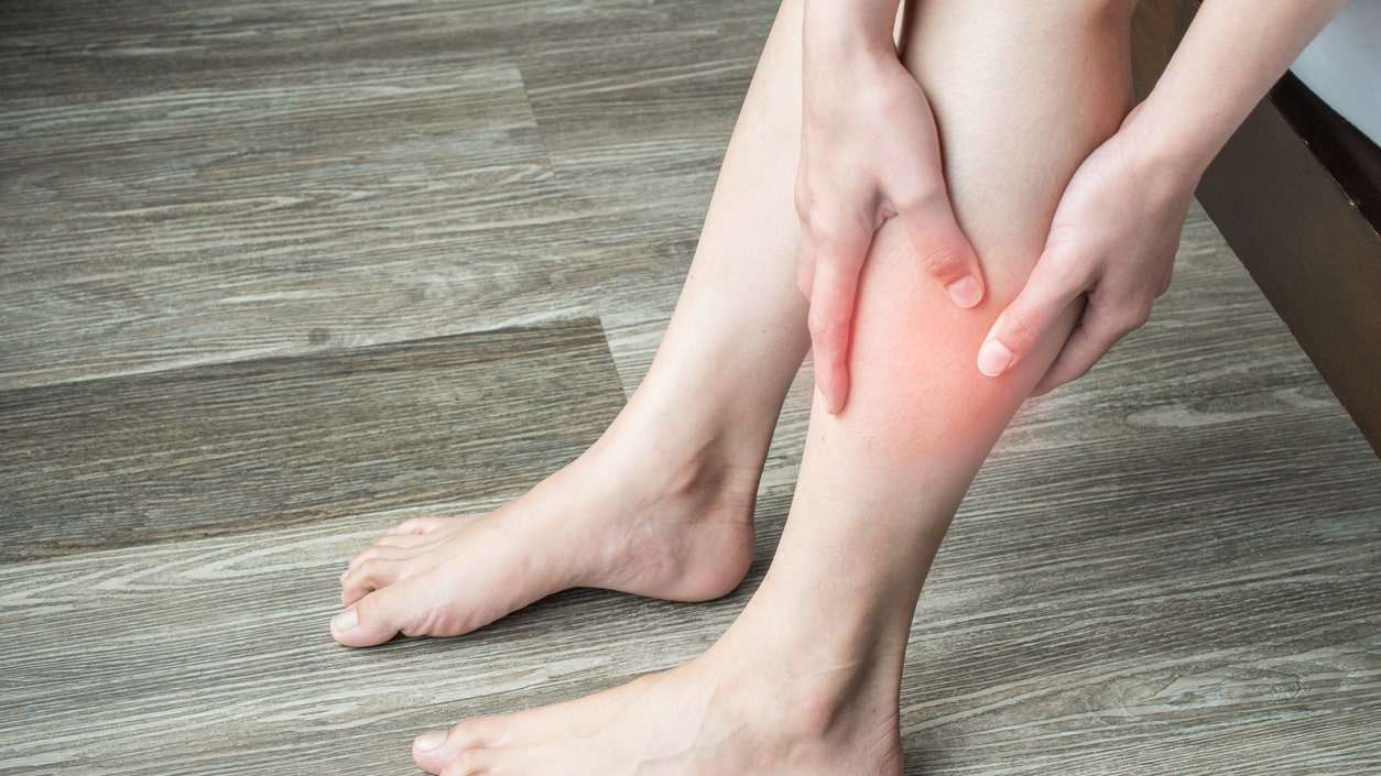 Manchas roxas que surgem espontaneamente após a musculação podem indicar predisposição a varizes