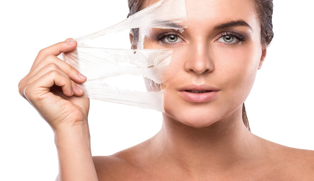 Peeling : procedimento é um sucesso no inverno