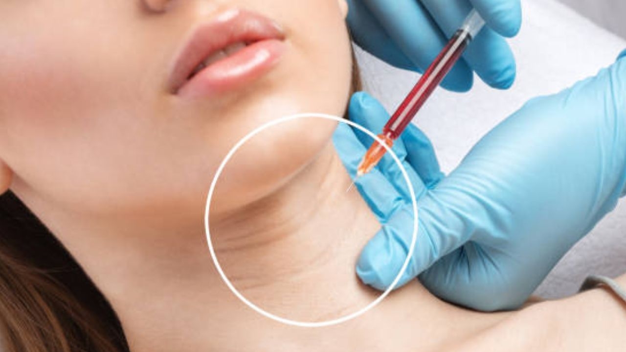 Aplicação da toxina botulínica deve ser estendida ao pescoço para melhorar sustentação facial