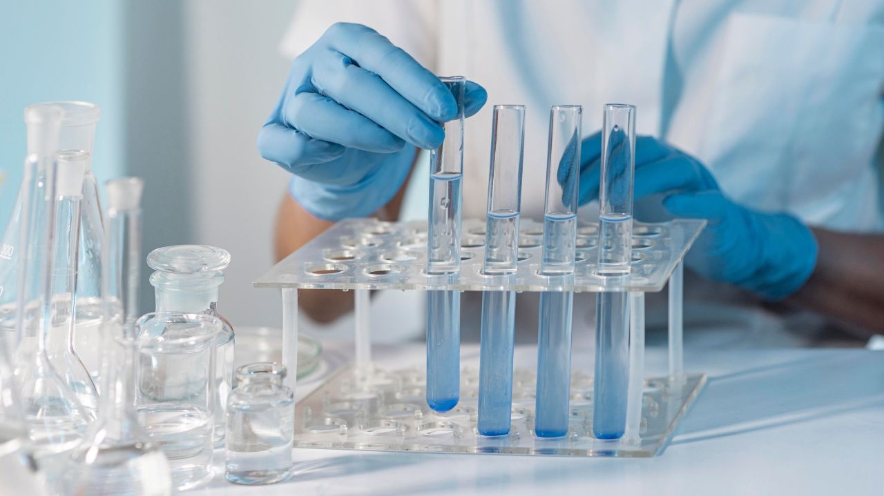 Anvisa autoriza farmácias a realizarem testes de análises clínicas