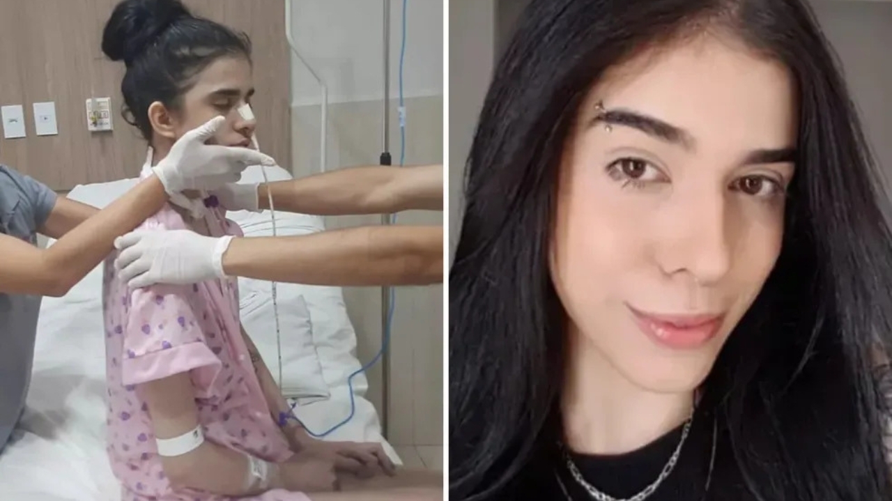 Jovem internada em Anápolis por cheirar pimenta recebe alta