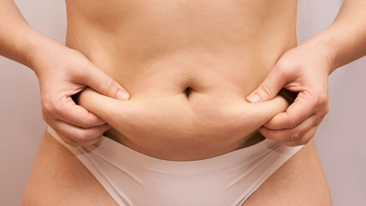 Veja qual tipo de cirurgia plástica Jojo Todynho vai precisar após bariátrica