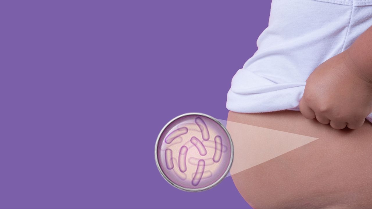 Saúde intestinal: desequilíbrio da microbiota e desordens associadas