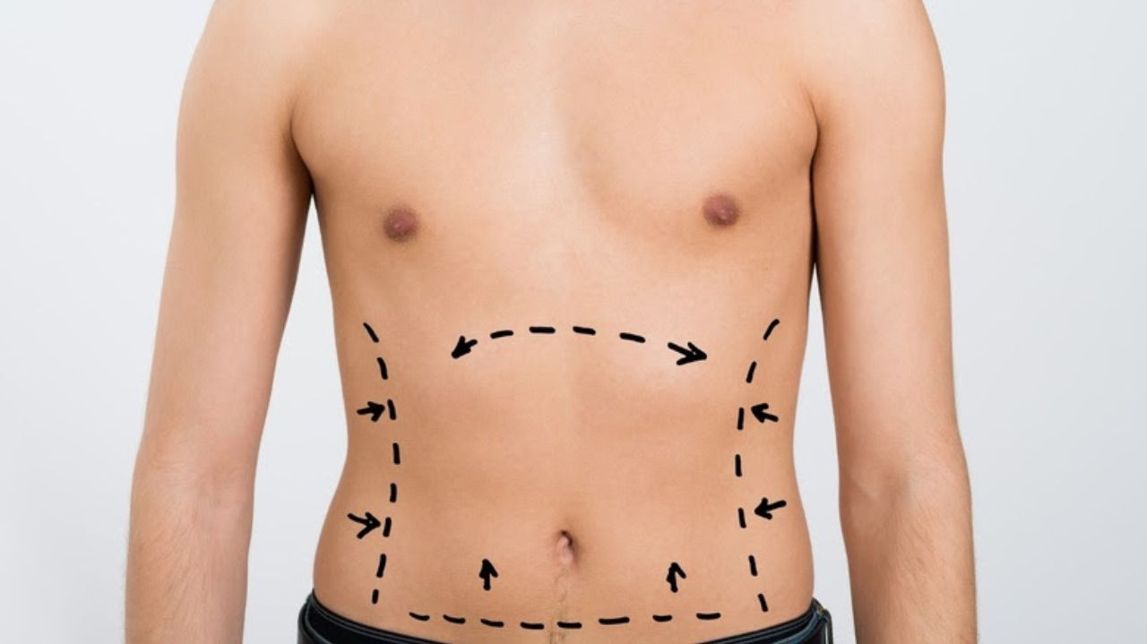 Busca masculina por cirurgias plásticas aumenta; veja a procura