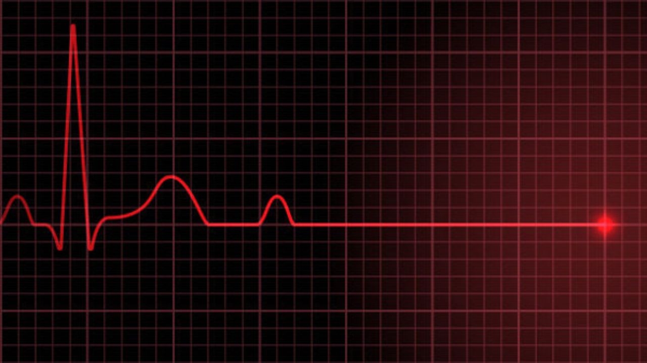 Estudo mostra que parada cardíaca pode dar sinais até 24 horas antes