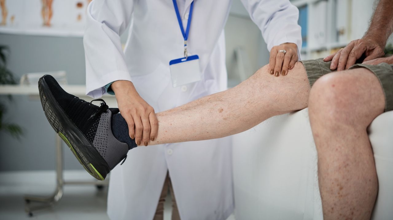 Queixas com as varizes aumentam de 20% a 30% no verão, entenda como aliviar os sintomas