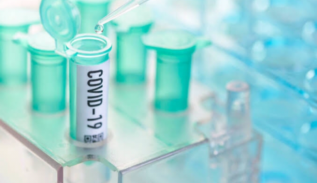 Coronavírus: Oxford anuncia testes clínicos em humanos