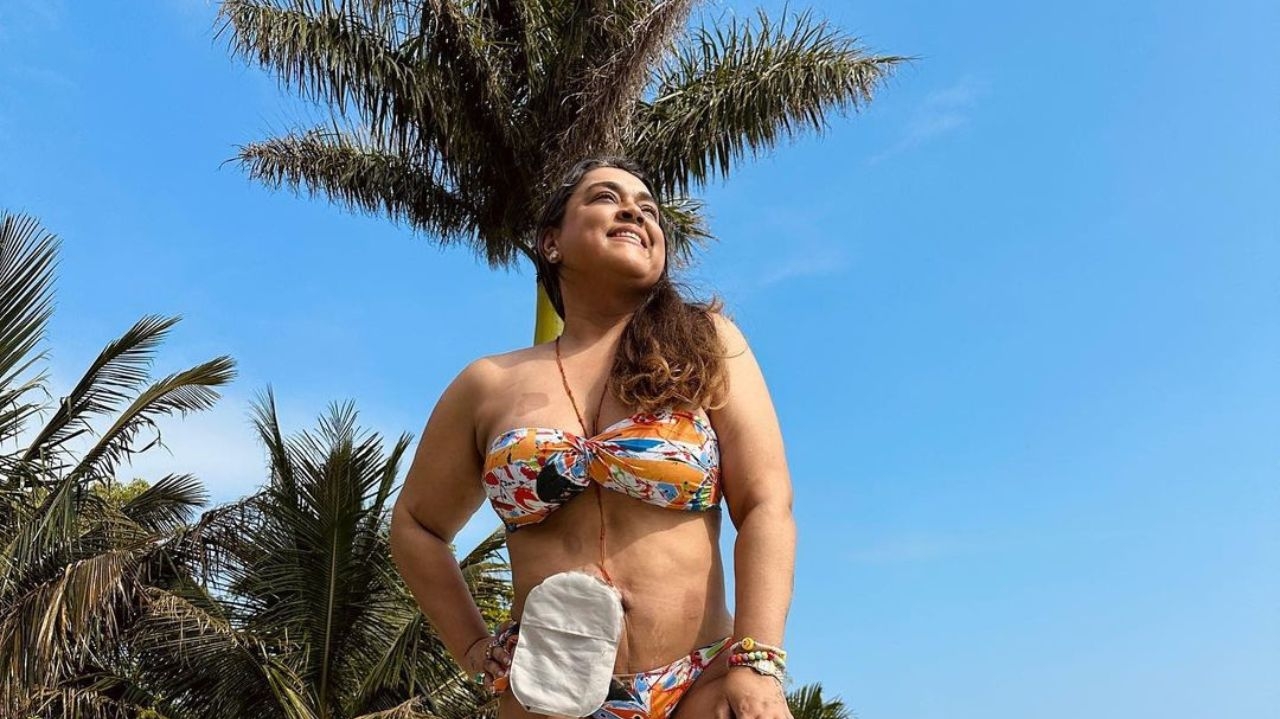 Preta Gil  é internada para retirar a bolsa de ileostomia