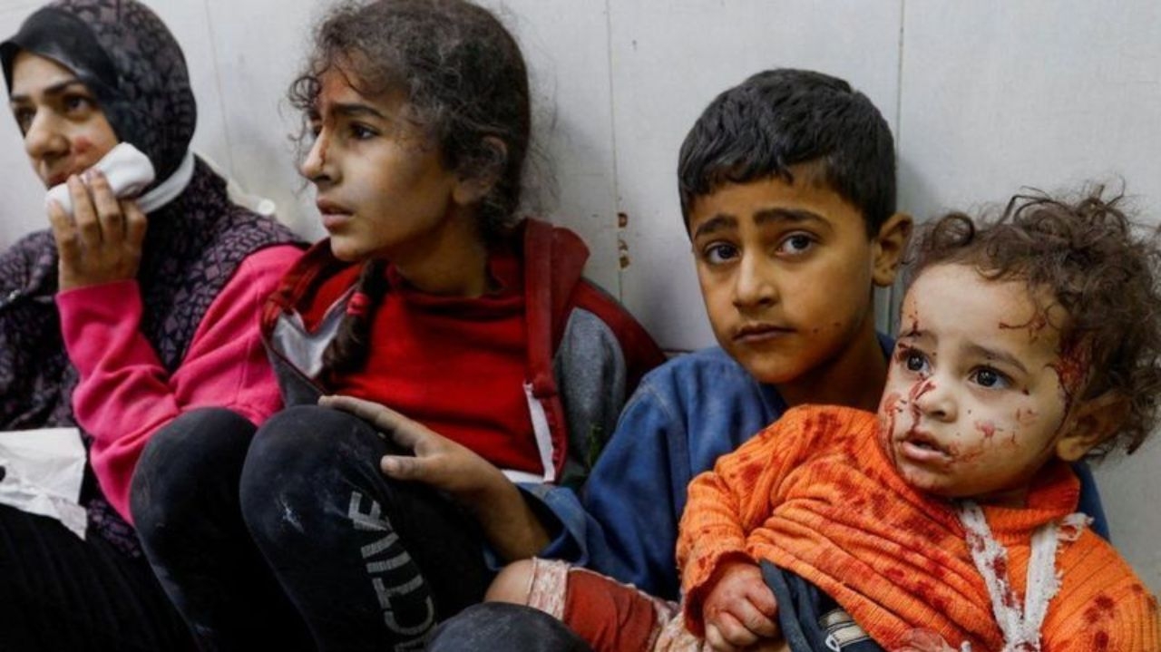Mais de 10 crianças perderam uma ou ambas as pernas todos os dias na Faixa de Gaza, afirma ONG