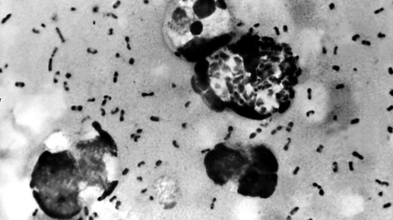 EUA identifica caso raro de Peste bubônica em humanos