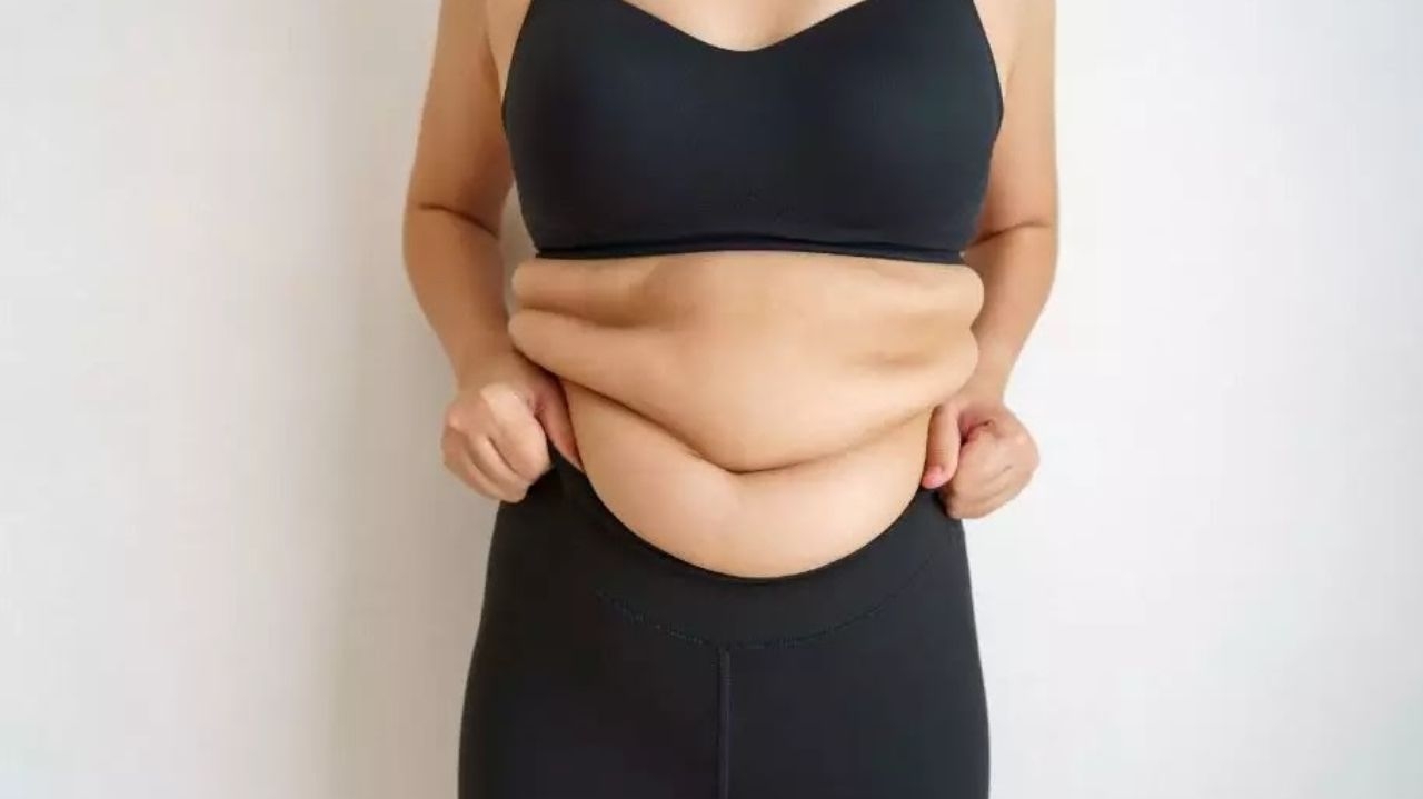 Procedimentos pós bariátrica: curiosidades e recomendações