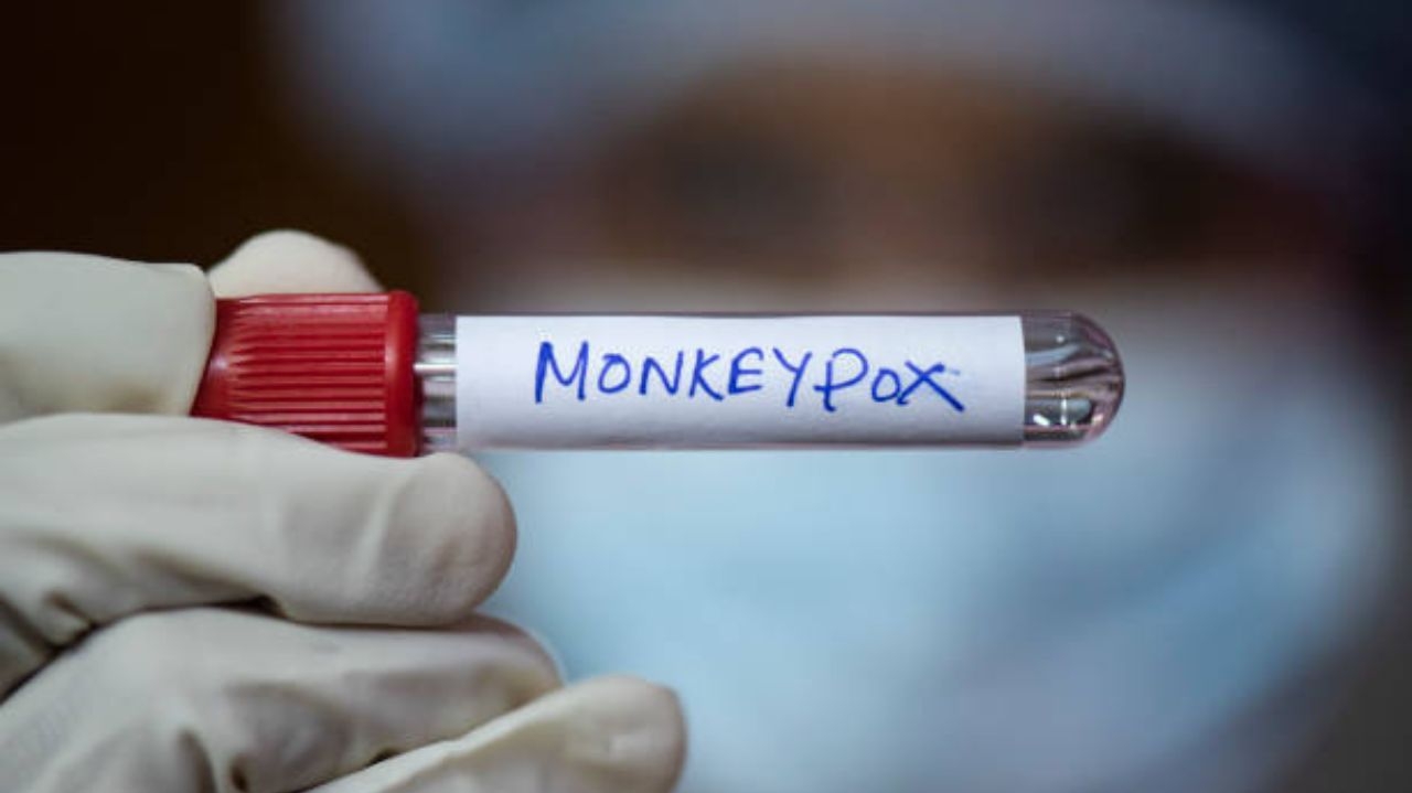 OMS decreta emergência de saúde global por disseminação de mpox