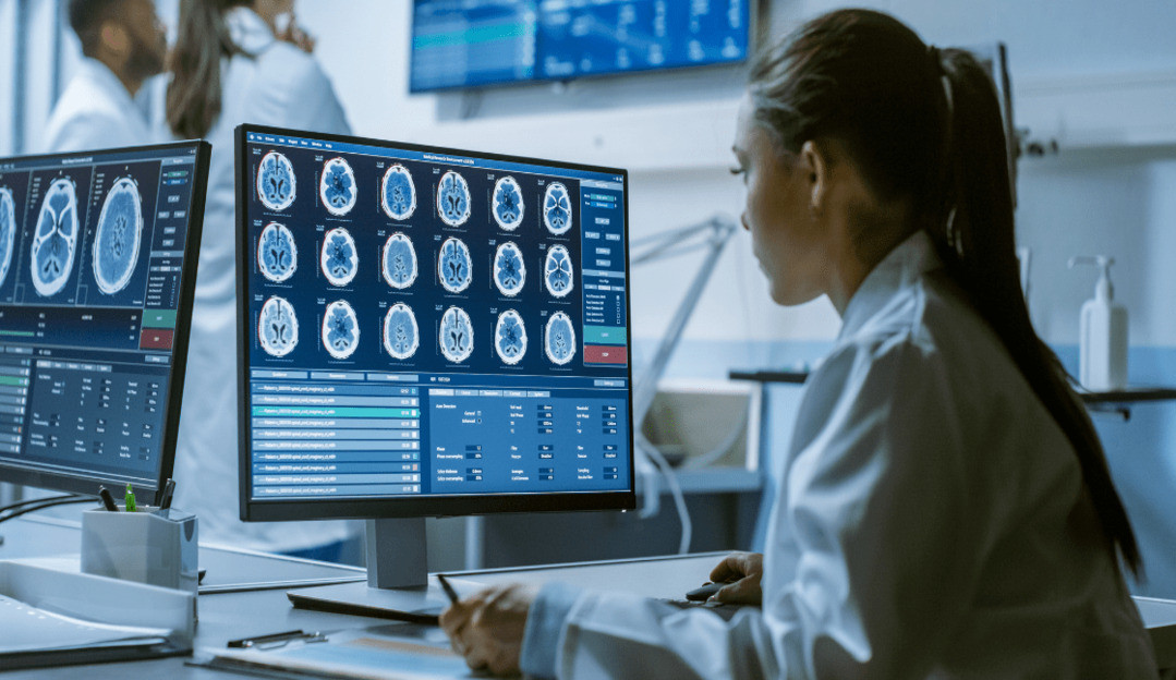 Inteligência Artificial demonstra eficácia na detecção de nódulos cancerígenos, segundo estudo