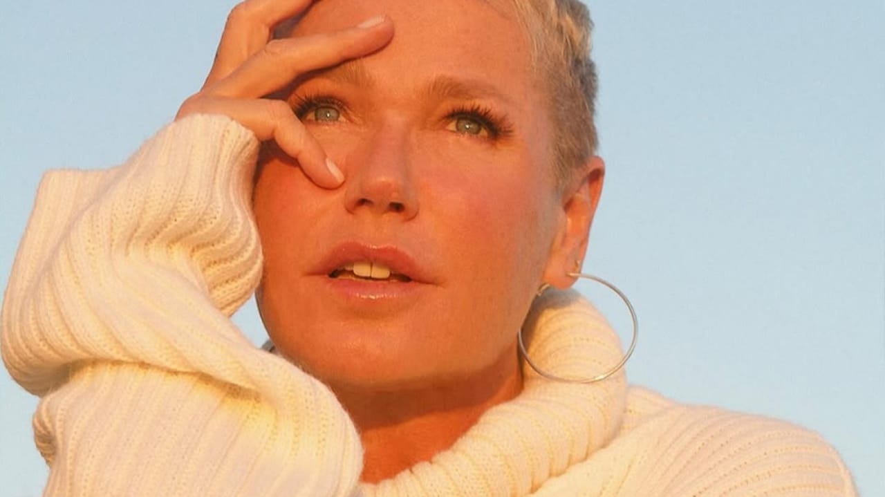 Calvície feminina: entenda diagnóstico de Xuxa