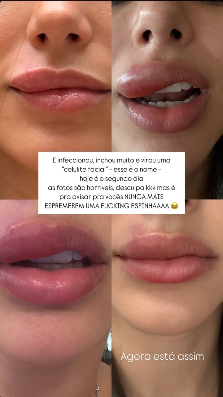 Storys Bruna Biancardi